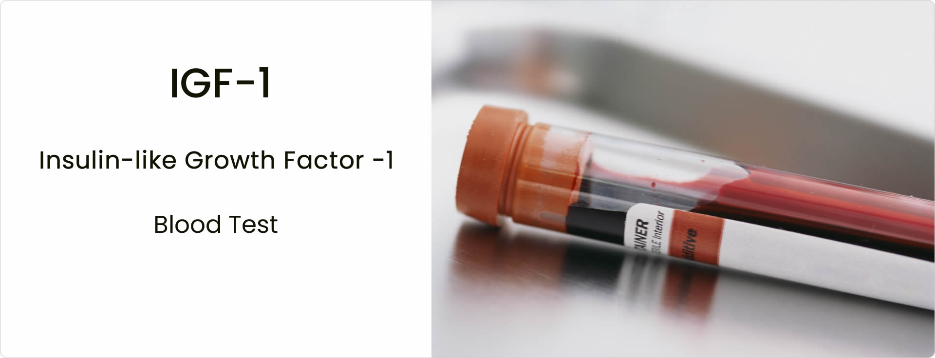IGF-1 blood test